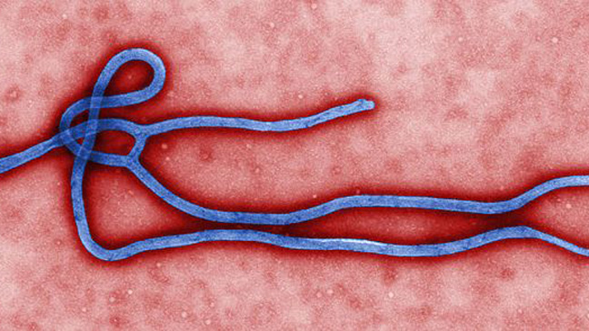 Ebola